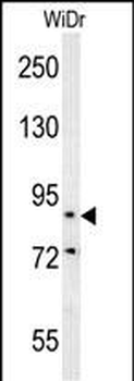 SLC39A10 Antibody (Center)