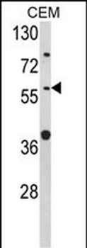 FMO1 Antibody (Center)