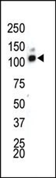 DDR1 Antibody (C-term)