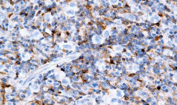 BAX Antibody