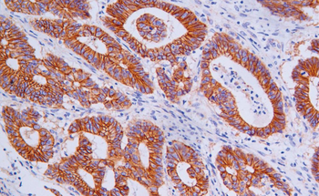 CTNNBIP1 Antibody