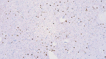 CALB2 Antibody