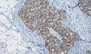 CDH1 Antibody