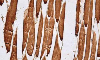 MB Antibody