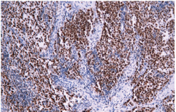 POU5F1 Antibody