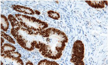 TP53 Antibody