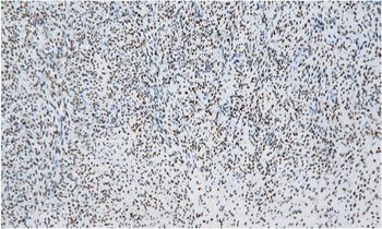 TLE1 Antibody