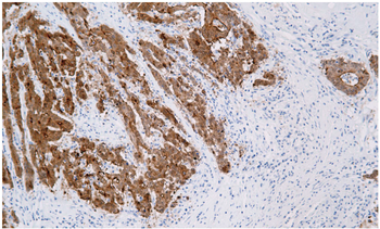 VIL1 Antibody
