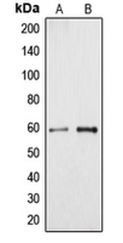 Cytochrome P450 4A11/22 Antibody