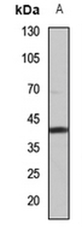 Anti-ZNT2 Antibody