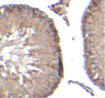 P2RY2 Rabbit Polyclonal Antibody