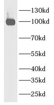 CDH6 Antibody