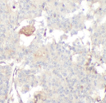 ACTA1 Rabbit Polyclonal Antibody