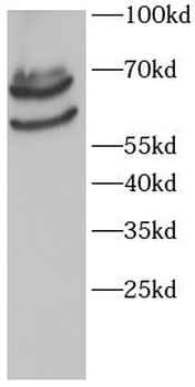 SPINT1 Rabbit Polyclonal Antibody