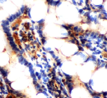 SPINT1 Rabbit Polyclonal Antibody