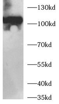 ROBO4 Rabbit Polyclonal Antibody