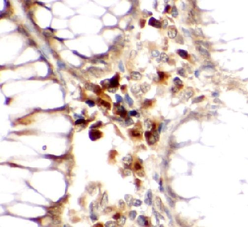 ROBO4 Rabbit Polyclonal Antibody