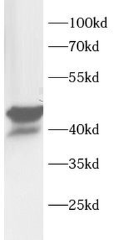 NEIL1 Rabbit Polyclonal Antibody