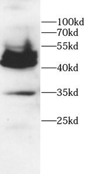 CD36 Antibody