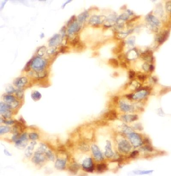 SLC34A2 Antibody