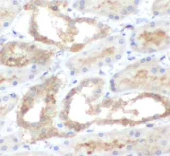 PADI2 Rabbit Polyclonal Antibody