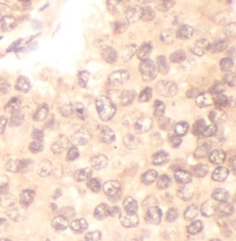 ADRA2B Rabbit Polyclonal Antibody