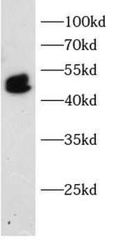 IRF5 Rabbit Polyclonal Antibody