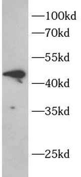 DHH Rabbit Polyclonal Antibody