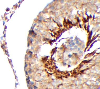 DHH Rabbit Polyclonal Antibody