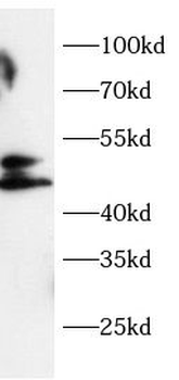 MICB Rabbit Polyclonal Antibody