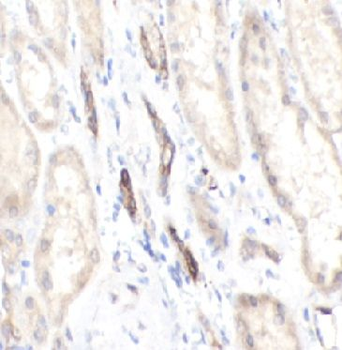 MICB Rabbit Polyclonal Antibody