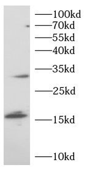 TREM1 Rabbit Polyclonal Antibody