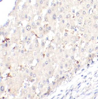 TREM1 Rabbit Polyclonal Antibody