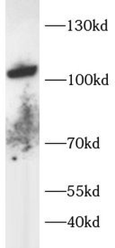 TRPV1 Rabbit Polyclonal Antibody