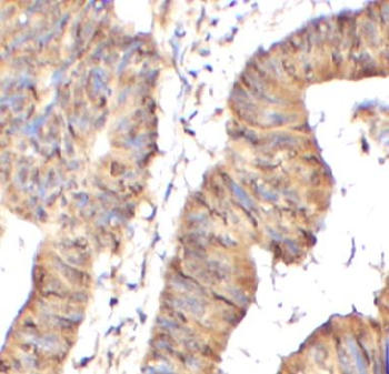 TRPV1 Rabbit Polyclonal Antibody