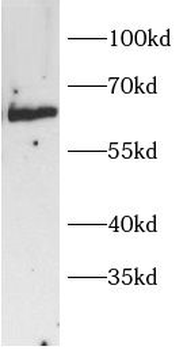 IRF2BP2 Rabbit Polyclonal Antibody