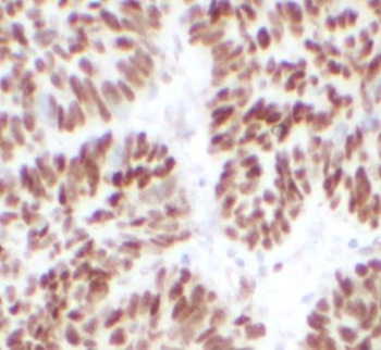 IRF2BP2 Rabbit Polyclonal Antibody