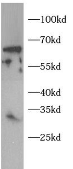 TWIST1 Antibody