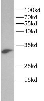 PRDX4 Rabbit Polyclonal Antibody