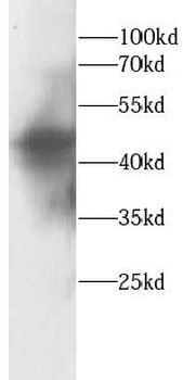 HNF1B Rabbit Polyclonal Antibody