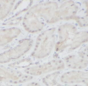 HNF1B Rabbit Polyclonal Antibody