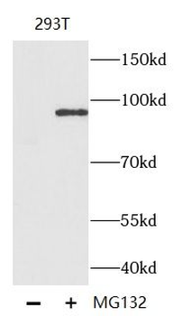 Phospho β Catenin Rabbit Polyclonal Antibody