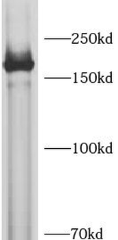 SASH1 Rabbit Polyclonal Antibody