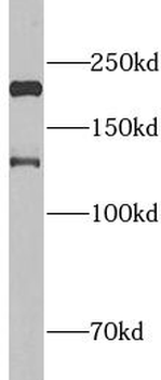 PPL Rabbit Polyclonal Antibody