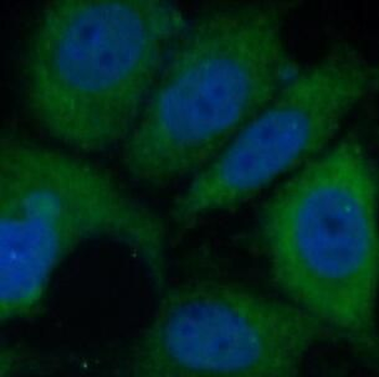 PPL Rabbit Polyclonal Antibody