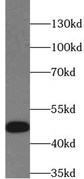GSK3B Mouse Monoclonal Antibody