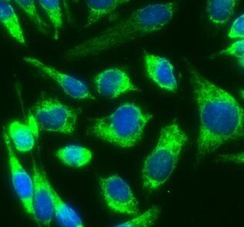 GSK3B Mouse Monoclonal Antibody