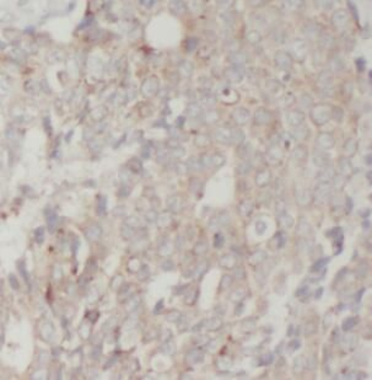 GSK3B Mouse Monoclonal Antibody
