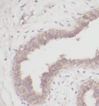 DMP1 Rabbit Polyclonal Antibody