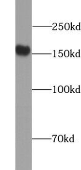 YTHDC2 Rabbit Polyclonal Antibody